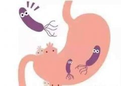 反流性胃炎的症状有哪些？如何饮食？