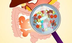 结肠炎的发病原因有哪些？