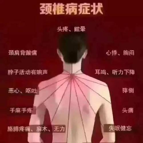 颈椎病，上海中医医院