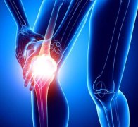 盘点引起膝关节炎的6个坏习惯
