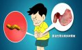 慢性浅表性胃炎有哪些表现？