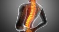 腰椎间盘突出症是怎么引起的？