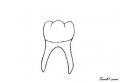 牙龈色泽改变当心是牙龈炎 如何防治牙龈炎呢